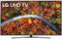 LG 70UP8100 - 70` (177cm), 4K UHD, e hirtë e errët